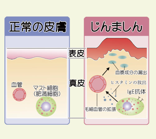 福岡市博多区の皮膚科 やまもと皮ふ科 Blog